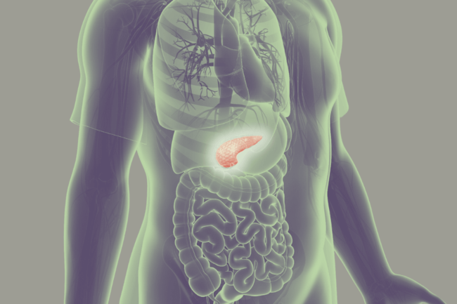 Pancreatic cancer
