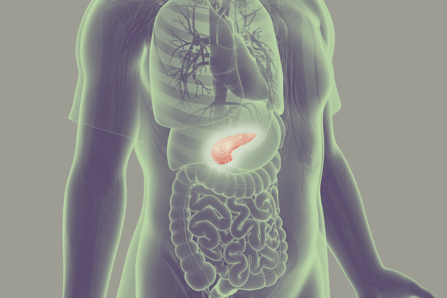 Pancreatic cancer