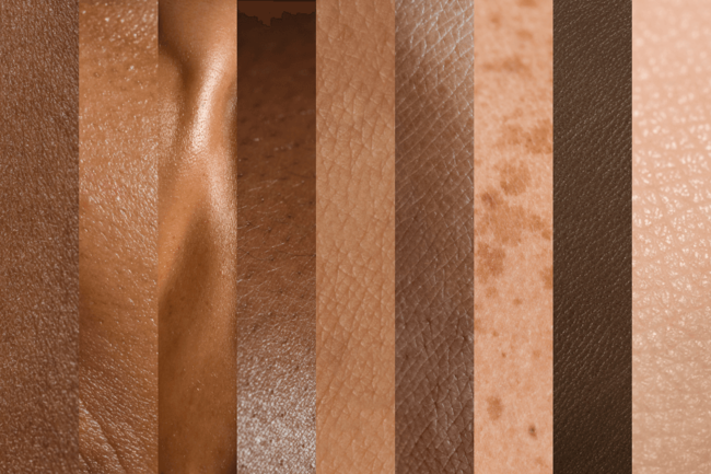 Illustration of skin
