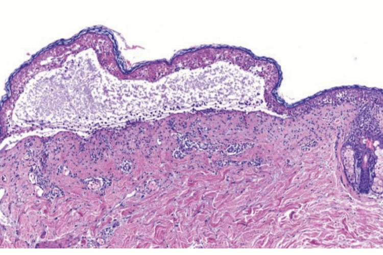 Histology of skin